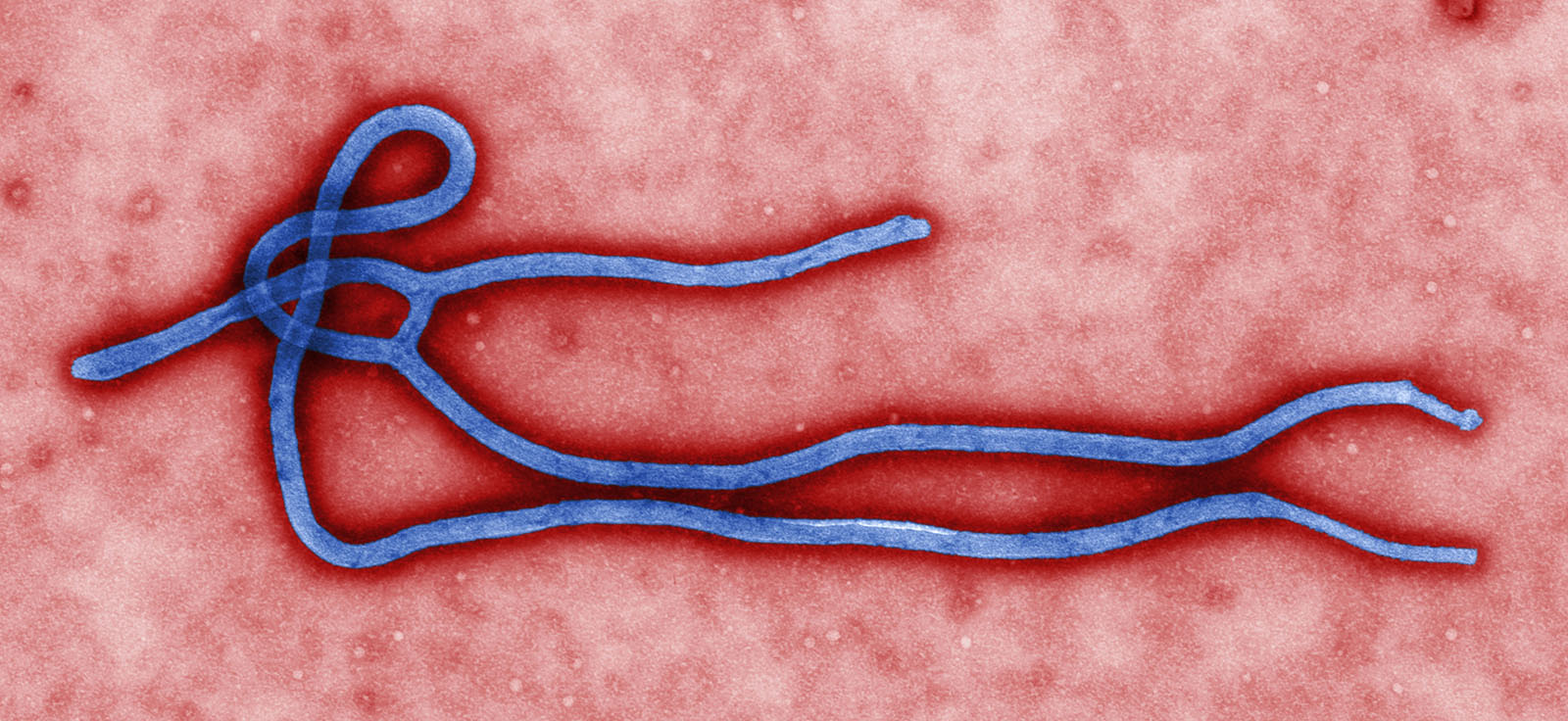 D-PCR16RP-ebola-F1 art28a-YR-Ebola-Fig1-10816-ebola-CDC