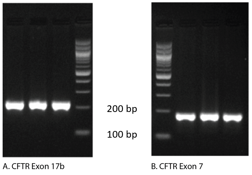 Gel electrophoresis of qPCR products shows single amplicons